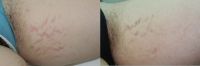 Click image to open!
